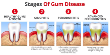 gumcare-image