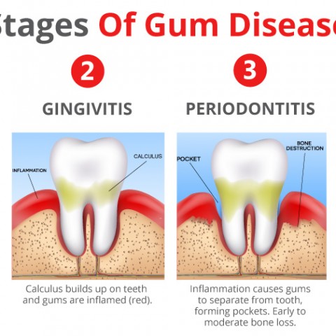 Blog - House Call Dentists House Call Dentists